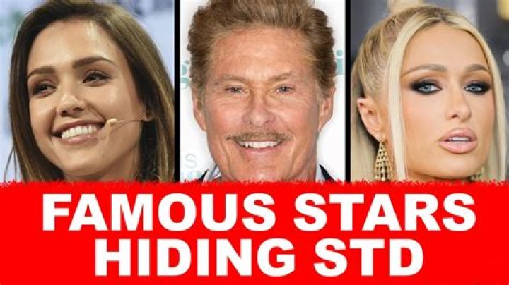 100 Celebrities with STDs List: A Comprehensive Guide