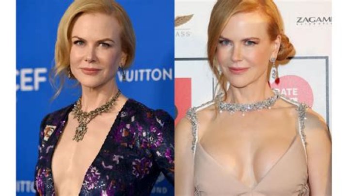Does Nicole Kidman Have Breast Implants? Unveiling the Truth