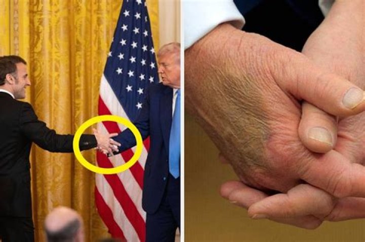 Is Donald Trump Left-Handed? Unraveling the Truth Behind the President's Dominant Hand