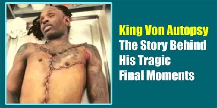 King Von Autopsy: Unveiling the Truth Behind the Tragic Loss