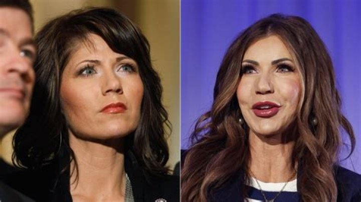 Kristi Noem Lips: A Closer Look at the Controversy and Public Perception