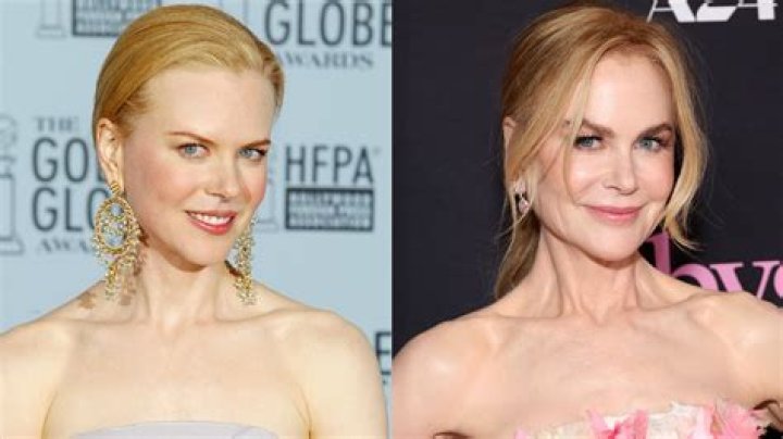 Nicole Kidman Plastic Surgery: Unveiling the Truth Behind the Glamour
