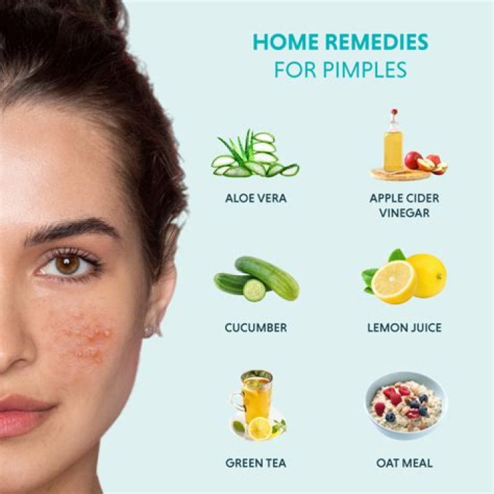 Vicks for Pimples: A Comprehensive Guide to Treating Acne Naturally